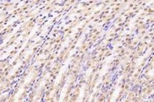 Immunohistochemistry (Paraffin-embedded Sections) (IHC (p)) image for anti-Uridine-Cytidine Kinase 1-Like 1 (UCKL1) antibody (ABIN7076157)