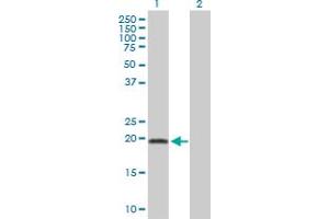 Western Blot analysis of ADI1 expression in transfected 293T cell line by ADI1 MaxPab polyclonal antibody. (ADI1 antibody  (AA 1-179))