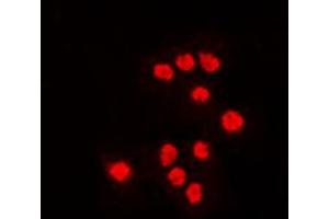 Immunofluorescent analysis of ATF7 staining in Jurkat cells. (ATF7 antibody  (Center))