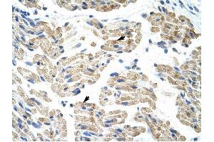 HNRPK antibody was used for immunohistochemistry at a concentration of 4-8 ug/ml to stain Skeletal muscle cells (arrows) in Human Muscle. (HNRNPK antibody  (C-Term))