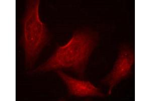 Immunofluorescence staining of methanol-fixed HeLa cells using NF-kappa,B-p65 (phospho-Ser311) antibody. (NF-kB p65 antibody  (pSer311))