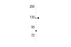 Western blot analysis of anti-TIE Antibody (N-term) (ABIN392060 and ABIN2841825) in mouse bladder tissue lysates (35 μg/lane). (TIE1 antibody  (N-Term))