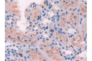 Immunohistochemistry (IHC) image for anti-Adenylate Cyclase 6 (ADCY6) (AA 314-501) antibody (ABIN7441871)