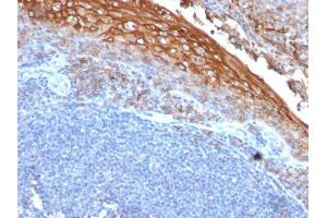 Formalin-fixed, paraffin-embedded human Tonsil stained with MUC18 Mouse Recombinant Monoclonal Antibody (rMUC18/1130).