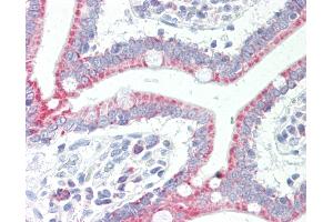 Human Small Intestine: Formalin-Fixed, Paraffin-Embedded (FFPE). (SLC33A1 antibody  (AA 216-265))
