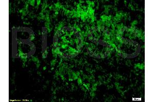 Immunofluorescence (IF) image for anti-Tumor Necrosis Factor alpha (TNF alpha) antibody (ABIN722481) (TNF alpha antibody)