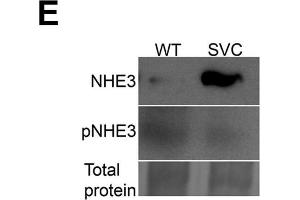 Analysis of renal function. (SLC9A3 antibody)