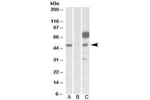 Western blot testing of HEK293 lysate overexpressing human ANGPT1-FLAG with ANGPT1 antibody [1ug/ml] in Lane A and probed with anti-FLAG [1/1000] in lane C. (Angiopoietin 1 antibody)