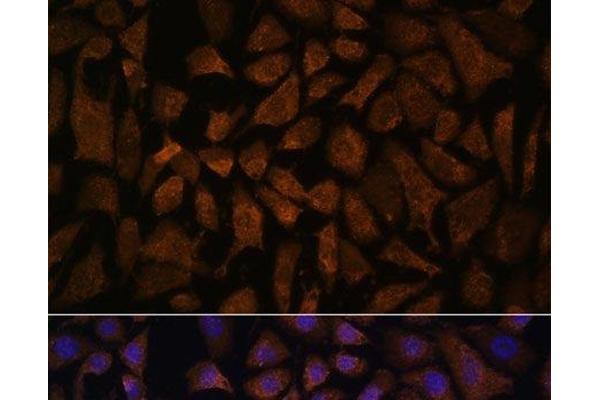 PPP2R5D antibody