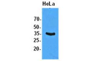 Western Blotting (WB) image for anti-Eukaryotic Translation Initiation Factor 2 Subunit 1 (EIF2S1) antibody (ABIN781544) (EIF2S1 antibody)