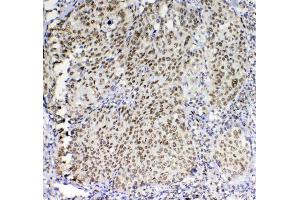 IHC analysis of PRDM1/Blimp1 using anti-PRDM1/Blimp1 antibody . (PRDM1 antibody  (AA 1-230))