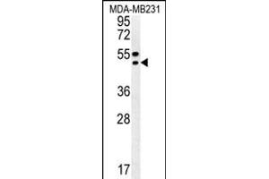 TR Antibody (C-term) (ABIN652176 and ABIN2840578) western blot analysis in MDA-M cell line lysates (35 μg/lane). (TRAM2 antibody  (C-Term))