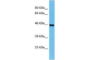 Western Blotting (WB) image for anti-Olfactory Receptor, Family 5, Subfamily T, Member 2 (OR5T2) (C-Term) antibody (ABIN2774565) (OR5T2 antibody  (C-Term))