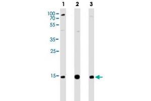 Western blot analysis of Lane 1: Hela cell line lysates Lane 2: THP-1 cell line lysates Lane 3: A431 cell line lysates reacted with VAMP8 monoclonal antibody  at 1:1000 dilution. (VAMP8 antibody  (N-Term))