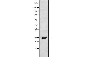 anti-NADH Dehydrogenase (Ubiquinone) Fe-S Protein 8, 23kDa (NADH-Coenzyme Q Reductase) (NDUFS8) (Internal Region) antibody