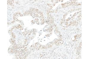 Immunohistochemistry (IHC) image for anti-RNA Polymerase II (pSer2) antibody (ABIN7454655) (RNA Polymerase II antibody  (pSer2))