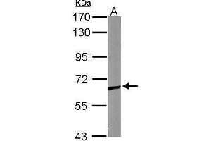 Western Blotting (WB) image for anti-Chaperonin Containing TCP1, Subunit 5 (Epsilon) (CCT5) antibody (ABIN2856715)