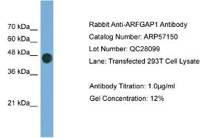 WB Suggested Anti-ARFGAP1  Antibody Titration: 0.