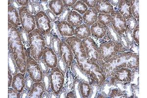 IHC-P Image BBOX1 antibody detects BBOX1 protein at cytoplasm on mouse kidney by immunohistochemical analysis. (BBOX1 antibody  (Center))