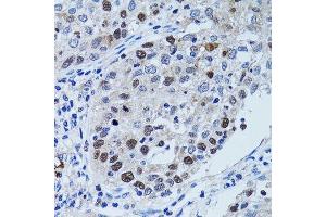 Immunohistochemistry (Paraffin-embedded Sections) (IHC (p)) image for anti-Ubiquitin-Like, Containing PHD and RING Finger Domains, 1 (UHRF1) (AA 1-260) antibody (ABIN3023232)