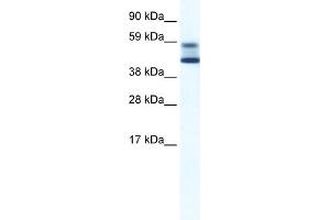 WB Suggested Anti-ZBTB7A Antibody Titration:  5. (ZBTB7A antibody  (N-Term))