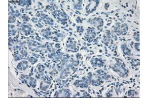 Immunohistochemical staining of paraffin-embedded breast tissue using anti-FCGR2A mouse monoclonal antibody.