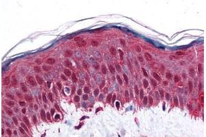 Human Skin: Formalin-Fixed, Paraffin-Embedded (FFPE) (Retinoblastoma Binding Protein 8 antibody  (AA 452-747))