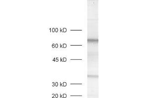 dilution: 1 : 1000, sample: rat retina extract (MPP4 antibody  (AA 197-216))