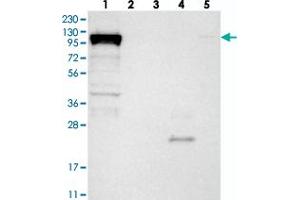 Western blot analysis of Lane 1: RT-4, Lane 2: U-251 MG, Lane 3: Human Plasma, Lane 4: Liver, Lane 5: Tonsil with DHX36 polyclonal antibody  at 1:250-1:500 dilution.