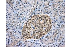 Immunohistochemical staining of paraffin-embedded liver tissue using anti-CAPZA1 mouse monoclonal antibody. (CAPZA1 antibody)