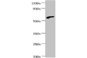 Western blot All lanes: RBBP5 antibody at 6 μg/mL + HepG2 whole cell lysate Secondary Goat polyclonal to rabbit IgG at 1/10000 dilution Predicted band size: 60, 56 kDa Observed band size: 60 kDa (RBBP5 antibody  (AA 319-538))