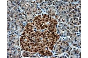 Immunohistochemical staining of paraffin-embedded Kidney tissue using anti-PSMC3 mouse monoclonal antibody.