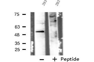 Western blot analysis of extracts from 293 cells, using IP6K3 antibody. (IP6K3 antibody  (Internal Region))