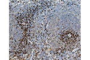 IHC analysis of CD8 alpha/Cd8a using anti-CD8 alpha/Cd8a antibody (ABIN7601570). (CD8 alpha antibody  (AA 39-245))