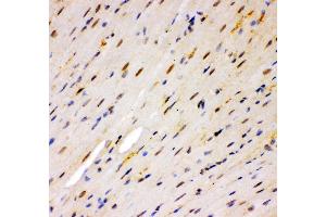 Anti- MSK1 Picoband antibody, IHC(P) IHC(P): Mouse Cardiac Muscle Tissue (MSK1 antibody  (AA 540-665))