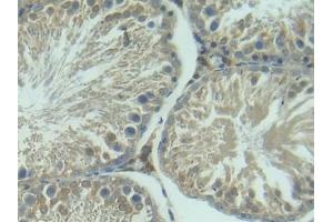 Detection of IGFBP3 in Rat Testis Tissue using Polyclonal Antibody to Insulin Like Growth Factor Binding Protein 3 (IGFBP3) (IGFBP3 antibody  (AA 137-274))