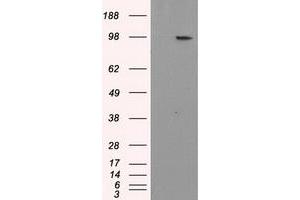 HEK293T cells were transfected with the pCMV6-ENTRY control (Left lane) or pCMV6-ENTRY APP (Right lane) cDNA for 48 hrs and lysed. (APP antibody)