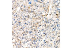 Immunohistochemistry (IHC) image for anti-Yes-Associated Protein 1 (YAP1) antibody (ABIN7271418)