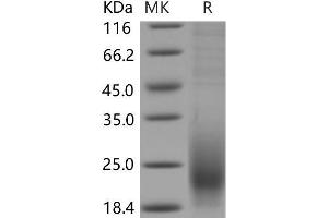 Western Blotting (WB) image for CD53 (CD53) (AA 107-181) protein (His tag) (ABIN7320175) (CD53 Protein (CD53) (AA 107-181) (His tag))