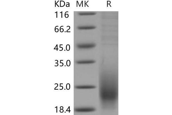 CD53 Protein (CD53) (AA 107-181) (His tag)