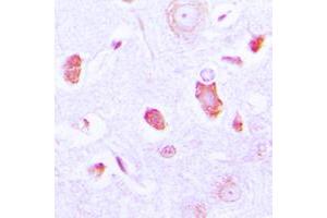 Immunohistochemical analysis of GUCY1A3 staining in human brain formalin fixed paraffin embedded tissue section. (GUCY1A1 antibody  (Center))