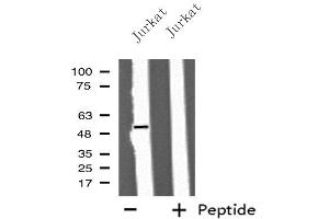 Western blot analysis of extracts from Jurkat cells, using IFIT5 antibody. (IFIT5 antibody  (Internal Region))
