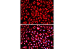 Immunofluorescence analysis of U2OS cells using IPO5 antibody (ABIN5971032). (Importin 5 antibody)