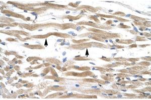 Human Muscle (KIFC2 antibody  (N-Term))