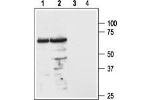Western blot analysis of mouse (lanes 1 and 3) and rat (lanes 2 and 4) brain lysates: - 1,2. (MC3R antibody  (1st Extracellular Loop))