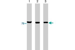 Western blot analysis using MARK3 polyclonal antibody on His-tagged c-tak1 (lane 1), RKO cell lysate (lane 2) and HCT-116 cell lysate (lane 3).