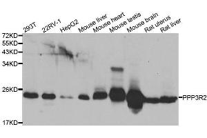 Western blot analysis of extracts of various cell lines, using PPP3R2 antibody. (Calcineurin B antibody  (AA 1-173))