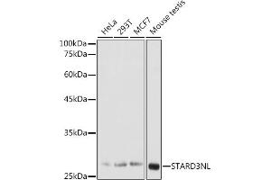 Western blot analysis of extracts of various cell lines, using STNL antibody (ABIN7270585) at 1:1000 dilution. (STARD3NL antibody  (AA 185-234))