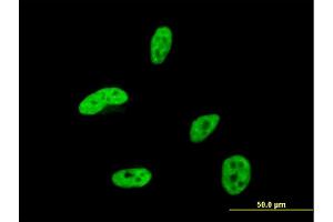 Immunofluorescence of monoclonal antibody to HOXA9 on HeLa cell. (HOXA9 antibody  (AA 1-272))