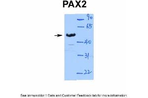WB Suggested Anti-PAX2 Antibody Titration: 1. (PAX2A antibody  (Middle Region))